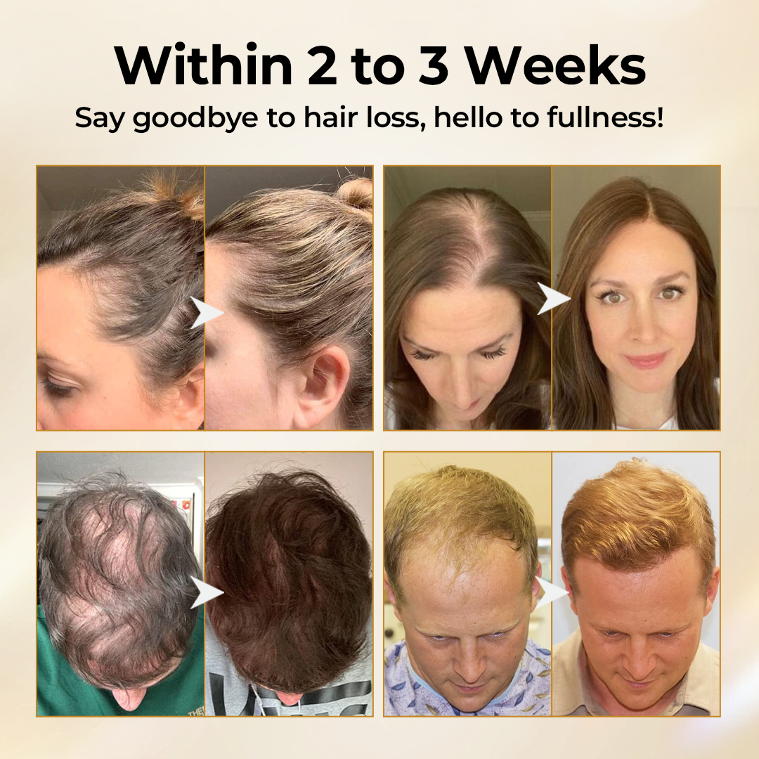 CollagenGrow Hair Restore Spray